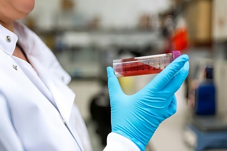 Virus Nəqliyyat Kit (qeyri-aktiv deyil) - Təhlükəsiz viral nümunə toplusu