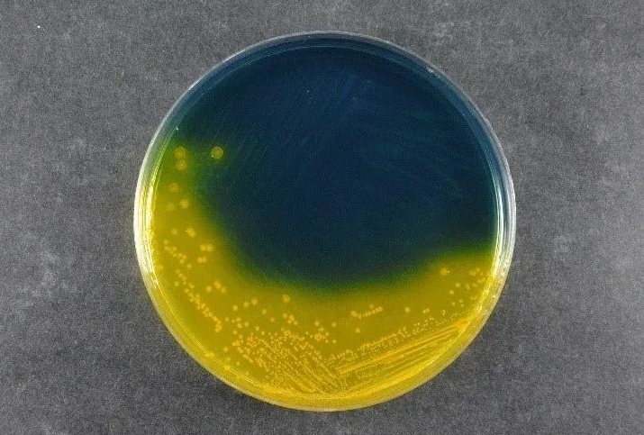 Qida təhlükəsizliyini təmin etmək: Babio'nun Salmonella Shigella Agar (SS) qlobal patogen aşkarlama standartlarını dəstəkləyir
