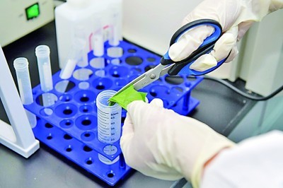 Etibarlı bakteriya identifikasiyası Babio'nun qram ləkəsi dəsti ilə sadə edildi