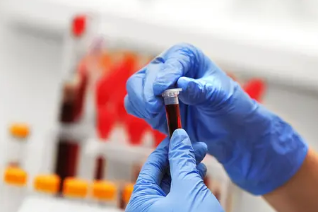 Babio, etibarlı klinik nümunə nəqliyyatı üçün maye amillər mediasını təqdim edir