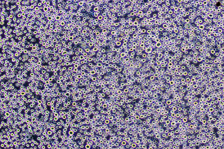 Kartof Dextrose Agar (USP) - Kalıp və maya aşkarlanması üçün etibarlı mühit