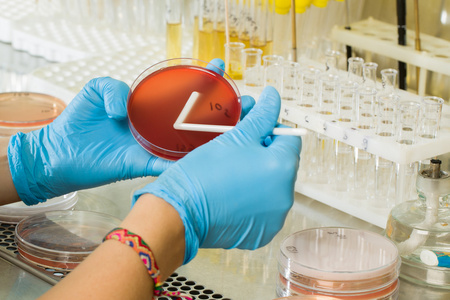 BABIO-nun MacConkey Agar Medium - Qlobal Mikrobioloji Diaqnostika üçün Premium Seçici İzolyasiya