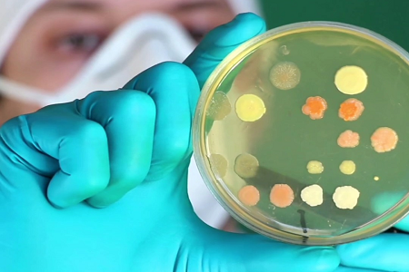 Qida Mikrobiologiyası və Probiotik Tədqiqatında Etibarlı MRS Ağarına Artan Tələb